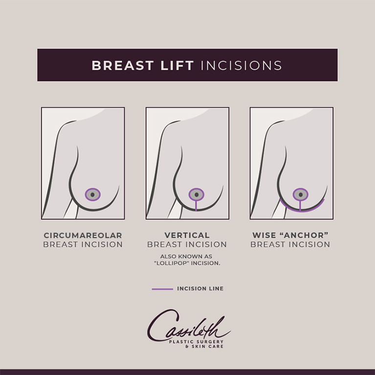 Woman breast lift, increase in size and reshape, line icon