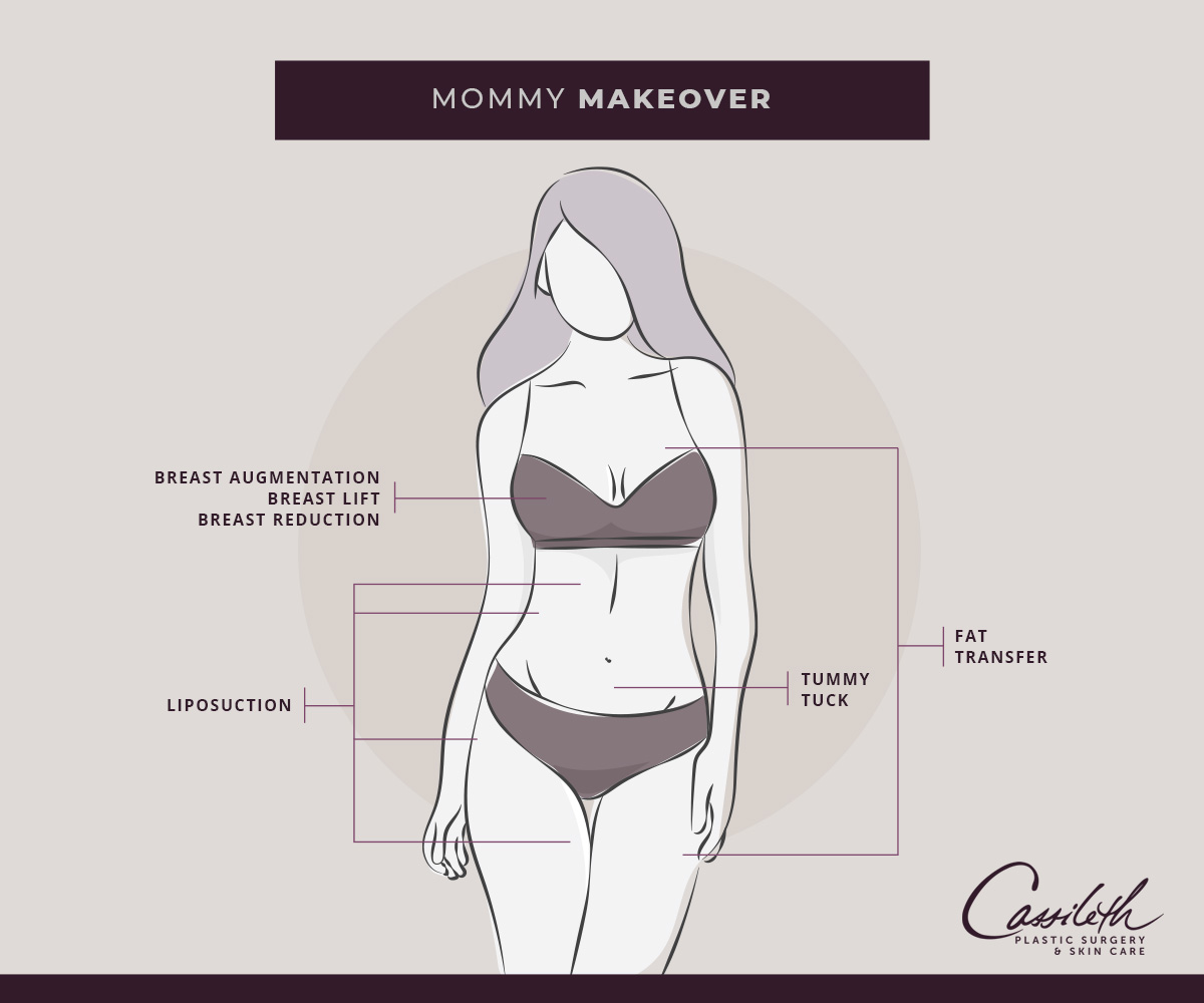 Tummy Tuck Surgery: Cost, Reviews, Before & After Los Angeles